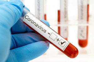 coronavirus test